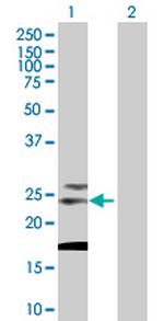 TSPAN31 Polyclonal Antibody, MaxPab™