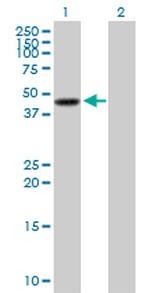 SERPINB3 Polyclonal Antibody, MaxPab™