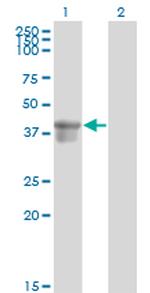 SERPINB3 Monoclonal Antibody (2F5)
