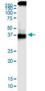 SCD Antibody in Western Blot (WB)