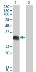 SCML1 Monoclonal Antibody (4G3)