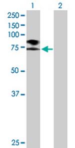 SCNN1B Polyclonal Antibody, MaxPab™