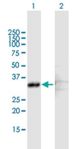 SCP2 Polyclonal Antibody, MaxPab™