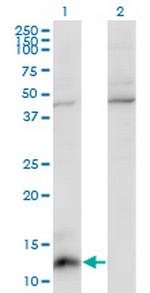 CCL7 Monoclonal Antibody (4B5)
