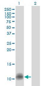 CCL14 Monoclonal Antibody (1F12)