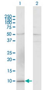 CCL15 Polyclonal Antibody, MaxPab™
