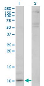 CXCL5 Monoclonal Antibody (M1)