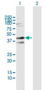 SDC2 Polyclonal Antibody, MaxPab™
