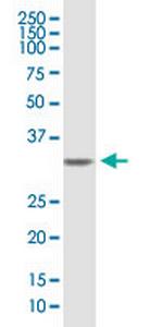 SDCBP Polyclonal Antibody, MaxPab™