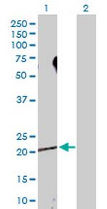 SDCBP Polyclonal Antibody, MaxPab™