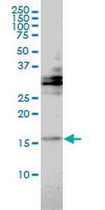 TRAPPC2 Monoclonal Antibody (2E10)