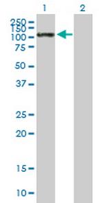 SELE Antibody in Western Blot (WB)