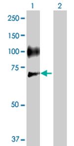 SELE Antibody in Western Blot (WB)