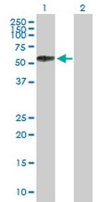 SELL Antibody in Western Blot (WB)
