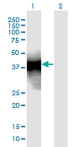 SFTPB Monoclonal Antibody (2H6)