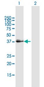 SFTPD Antibody in Western Blot (WB)
