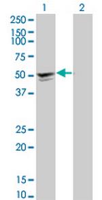 SGCA Monoclonal Antibody (3C4)