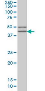 SGCB Monoclonal Antibody (1C10)