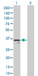 SGCG Polyclonal Antibody, MaxPab™