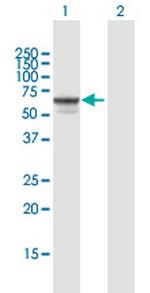 SGSH Polyclonal Antibody, MaxPab™
