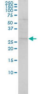 SH3BGR Monoclonal Antibody (3B7)