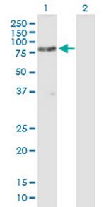 SH3BP2 Antibody in Western Blot (WB)