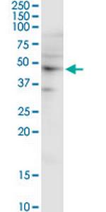 SH3GL1 Monoclonal Antibody (2B5)