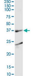 SH3GL1 Monoclonal Antibody (1B8)
