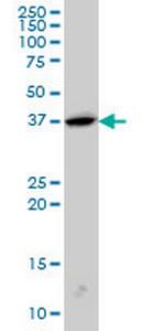 SH3GL2 Monoclonal Antibody (5A6)