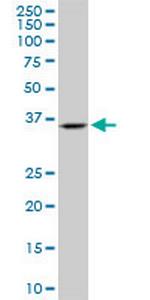 SH3GL2 Monoclonal Antibody (2G6)