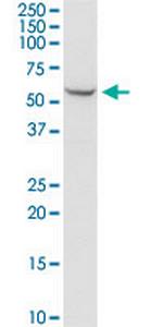 SHMT2 Monoclonal Antibody (5E7)