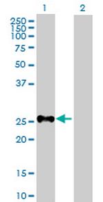 SHOX Polyclonal Antibody, MaxPab™
