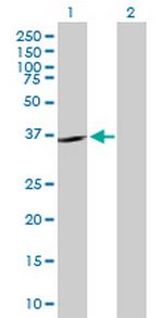 SHOX2 Polyclonal Antibody, MaxPab™