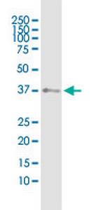 SHOX2 Antibody in Western Blot (WB)