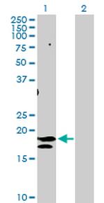 ST6GAL1 Polyclonal Antibody, MaxPab™