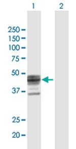 ST3GAL1 Polyclonal Antibody, MaxPab™