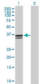 ST3GAL2 Polyclonal Antibody, MaxPab™