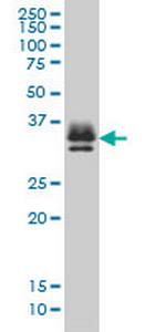 ST3GAL2 Monoclonal Antibody (1E12)