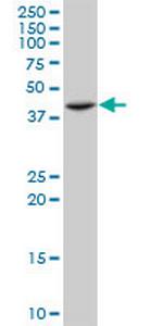 ST3GAL4 Monoclonal Antibody (1F4)
