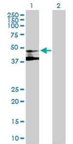 ST3GAL3 Polyclonal Antibody, MaxPab™