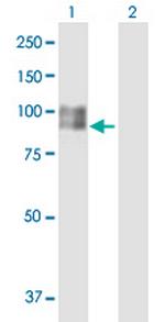 SILV Antibody in Western Blot (WB)