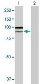 SILV Antibody in Western Blot (WB)