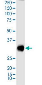 SIX3 Polyclonal Antibody, MaxPab™