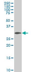 SIX3 Monoclonal Antibody (3F1)