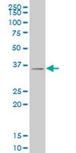 SIX3 Monoclonal Antibody (1A2)