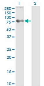 SKIL Antibody in Western Blot (WB)