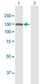 SKIV2L Polyclonal Antibody, MaxPab™