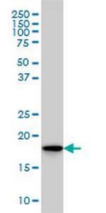 SKP1A Monoclonal Antibody (1H8)