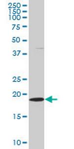 SKP1A Monoclonal Antibody (2E6)