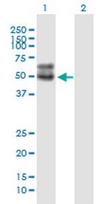 SLC2A4 Monoclonal Antibody (1F12)